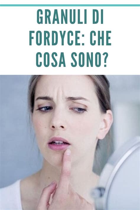 i granuli di fordyce|Granuli di Fordyce: cosa sono e perché compaiono